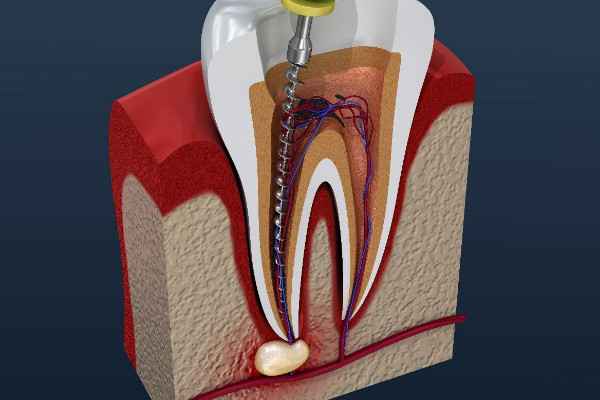 top endodontist